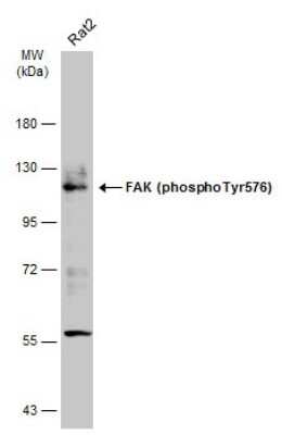 Western Blot: FAK [p Tyr576] Antibody [NBP3-13071]